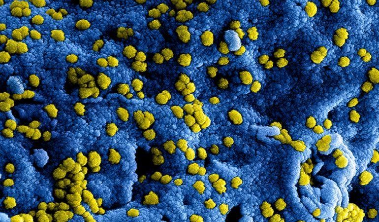 blauwe met gele puntjes staat voor het Coronavirus